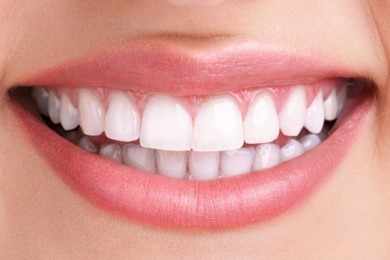 Bright, healthy white smile after treatment at Crystal Dental Care in Jacó