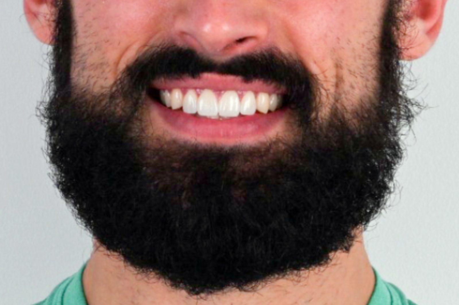 Happy patient with a healthy new smile from Crystal Dental Care in Jacó